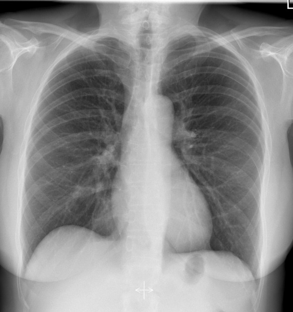 cxr