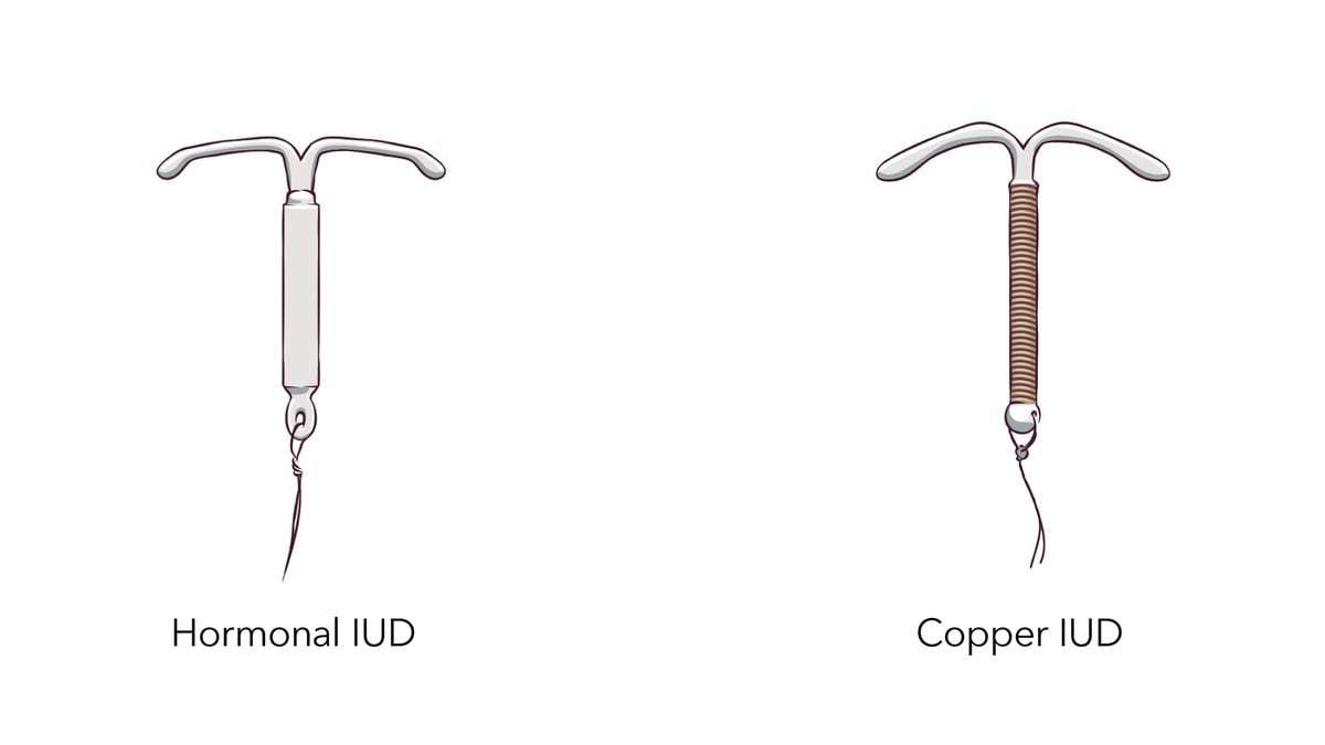 IUD Birth Control | Info About Mirena & Paragard IUDs